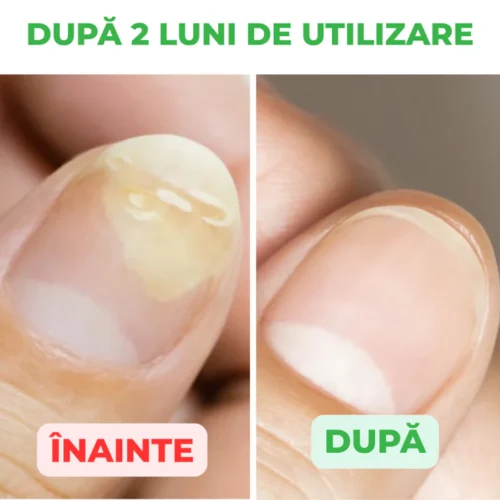Solutie tratament pentru unghii si piele, 30ml
