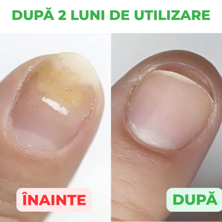 Solutie tratament pentru unghii si piele, 30ml - imagine 4